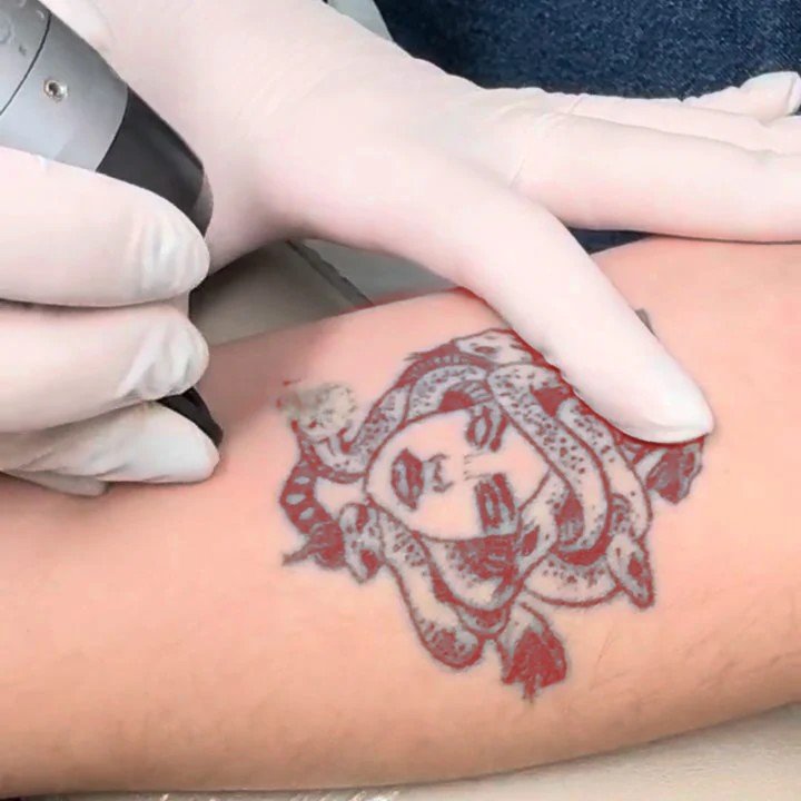 ¿Por qué la tinta roja de los tatuajes puede causar problemas?